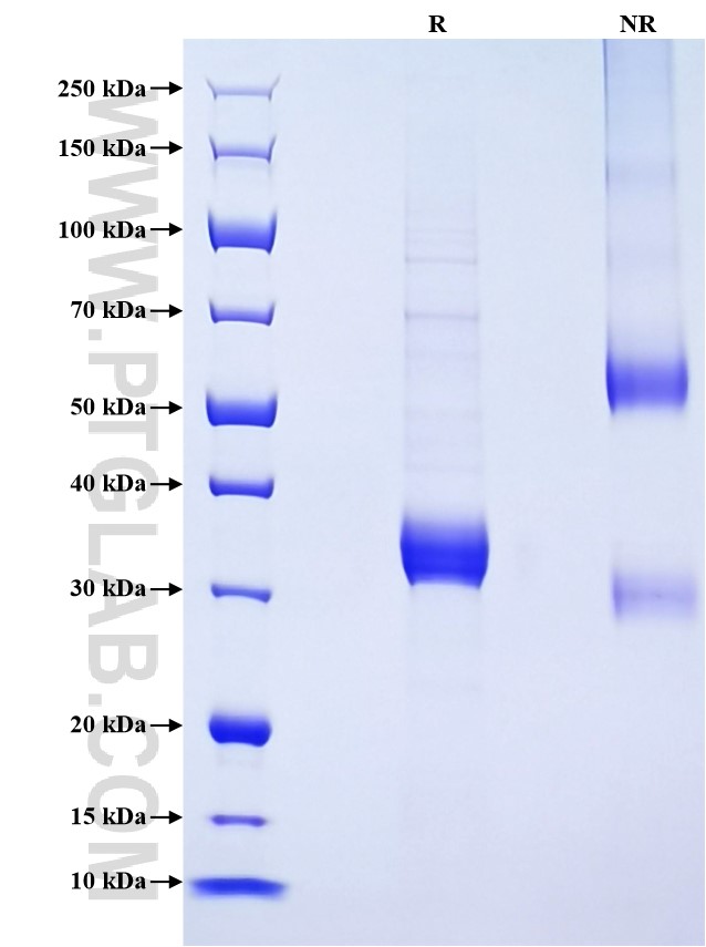 Purity of Recombinant Human CORT was determined by SDS-PAGE. The protein was resolved in an SDS-PAGE in reducing (R) and non-reducing (NR) conditions and stained using Coomassie blue. Purity of Recombinant Human CORT was determined by SDS-PAGE. The protein was resolved in an SDS-PAGE in reducing (R) and non-reducing (NR) conditions and stained using Coomassie blue.