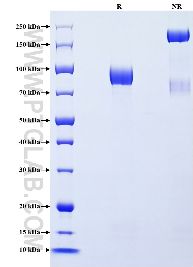 Purity of Recombinant Human GFRA2 was determined by SDS-PAGE. The protein was resolved in an SDS-PAGE in reducing (R) and non-reducing (NR) conditions and stained using Coomassie blue. Purity of Recombinant Human GFRA2 was determined by SDS-PAGE. The protein was resolved in an SDS-PAGE in reducing (R) and non-reducing (NR) conditions and stained using Coomassie blue.