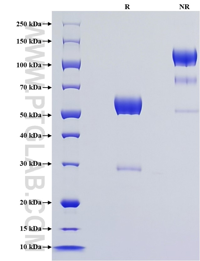 Purity of Recombinant Mouse Oncostatin M was determined by SDS-PAGE. The protein was resolved in an SDS-PAGE in reducing (R) and non-reducing (NR) conditions and stained using Coomassie blue.
