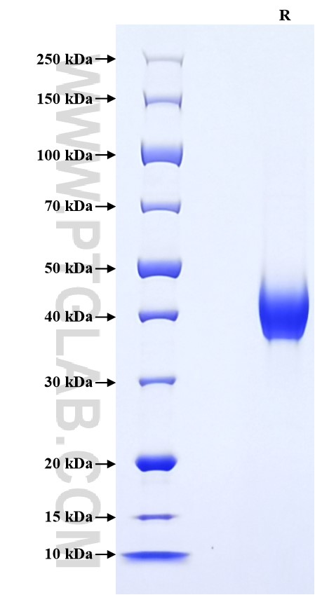 Purity of Recombinant Human PRRG1 was determined by SDS-PAGE. The protein was resolved in an SDS-PAGE in reducing (R) conditions and stained using Coomassie blue. Purity of Recombinant Human PRRG1 was determined by SDS-PAGE. The protein was resolved in an SDS-PAGE in reducing (R) conditions and stained using Coomassie blue.