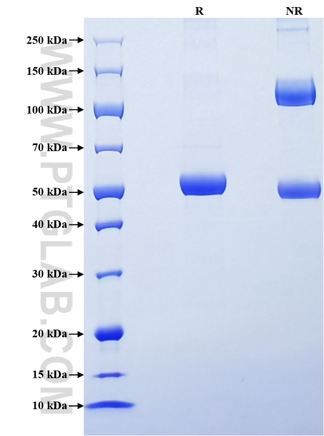 Purity of Recombinant Mouse Cardiotrophin-1 was determined by SDS-PAGE. The protein was resolved in an SDS-PAGE in reducing (R) and non-reducing (NR) conditions and stained using Coomassie blue. Purity of Recombinant Mouse Cardiotrophin-1 was determined by SDS-PAGE. The protein was resolved in an SDS-PAGE in reducing (R) and non-reducing (NR) conditions and stained using Coomassie blue.