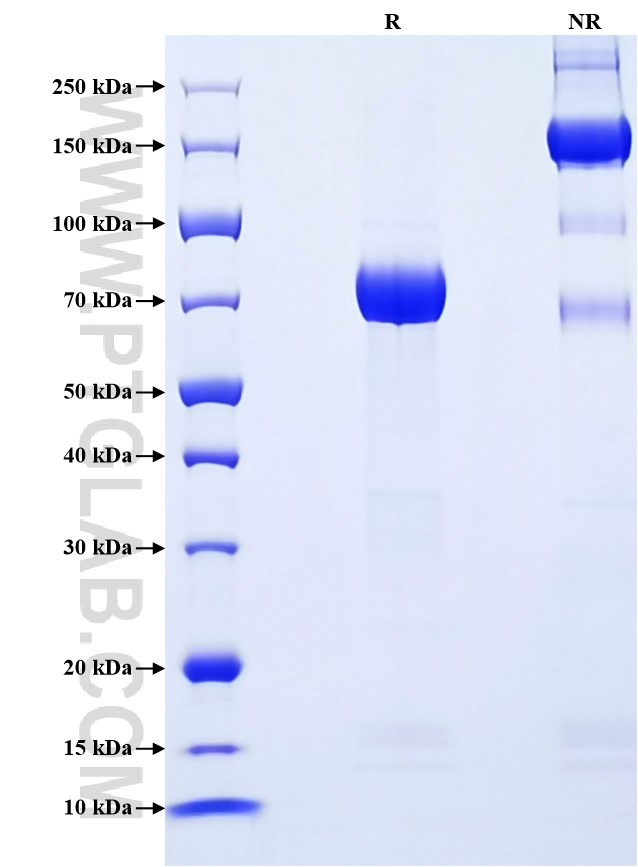 Purity of Recombinant Human NRG2 was determined by SDS-PAGE. The protein was resolved in an SDS-PAGE in reducing (R) and non-reducing (NR) conditions and stained using Coomassie blue. Purity of Recombinant Human NRG2 was determined by SDS-PAGE. The protein was resolved in an SDS-PAGE in reducing (R) and non-reducing (NR) conditions and stained using Coomassie blue.