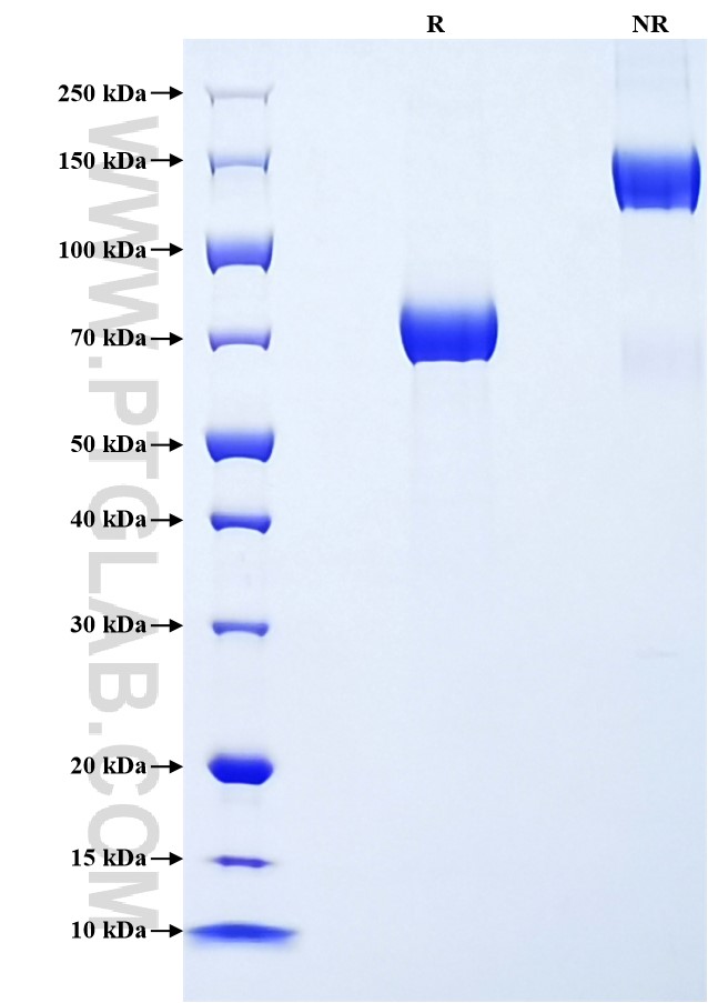 Purity of Recombinant Human SIGLEC14 was determined by SDS-PAGE. The protein was resolved in an SDS-PAGE in reducing (R) and non-reducing (NR) conditions and stained using Coomassie blue. Purity of Recombinant Human SIGLEC14 was determined by SDS-PAGE. The protein was resolved in an SDS-PAGE in reducing (R) and non-reducing (NR) conditions and stained using Coomassie blue.