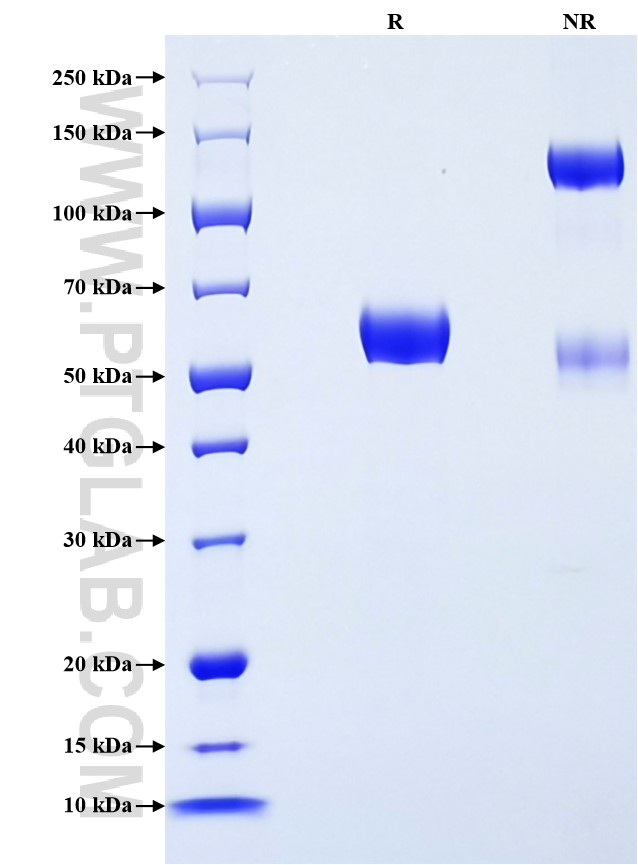 Purity of Recombinant Human Ephrin B1 was determined by SDS-PAGE. The protein was resolved in an SDS-PAGE in reducing (R) and non-reducing (NR) conditions and stained using Coomassie blue. Purity of Recombinant Human Ephrin B1 was determined by SDS-PAGE. The protein was resolved in an SDS-PAGE in reducing (R) and non-reducing (NR) conditions and stained using Coomassie blue.