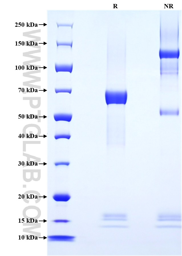 Purity of Recombinant Human TGFBR3L was determined by SDS-PAGE. The protein was resolved in an SDS-PAGE in reducing (R) and non-reducing (NR) conditions and stained using Coomassie blue. Purity of Recombinant Human TGFBR3L was determined by SDS-PAGE. The protein was resolved in an SDS-PAGE in reducing (R) and non-reducing (NR) conditions and stained using Coomassie blue.