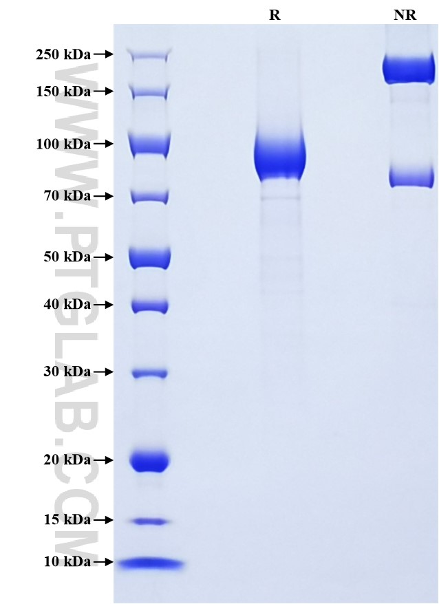 Purity of Recombinant Human EPHB6 was determined by SDS-PAGE. The protein was resolved in an SDS-PAGE in reducing (R) and non-reducing (NR) conditions and stained using Coomassie blue.