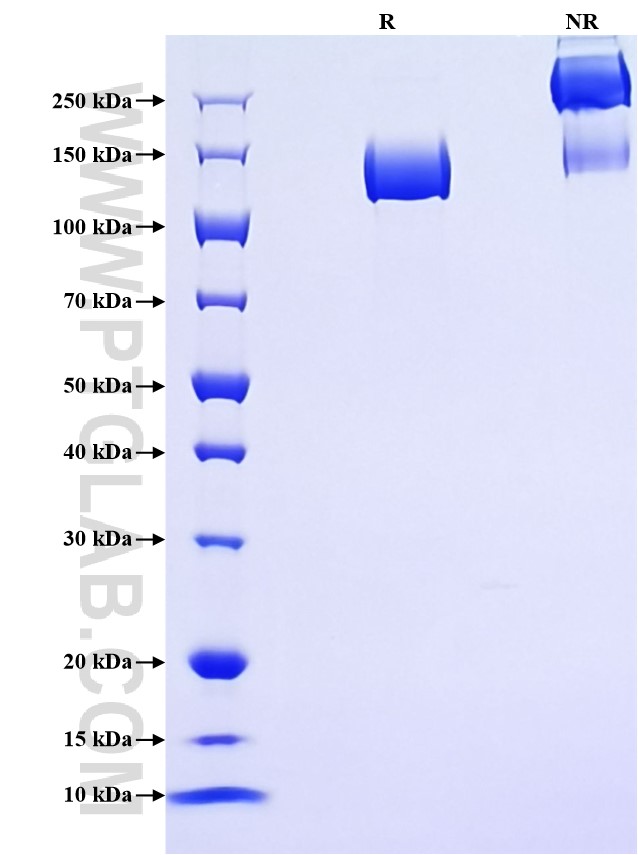 Purity of Recombinant Mouse ENPEP was determined by SDS-PAGE. The protein was resolved in an SDS-PAGE in reducing (R) and non-reducing (NR) conditions and stained using Coomassie blue.