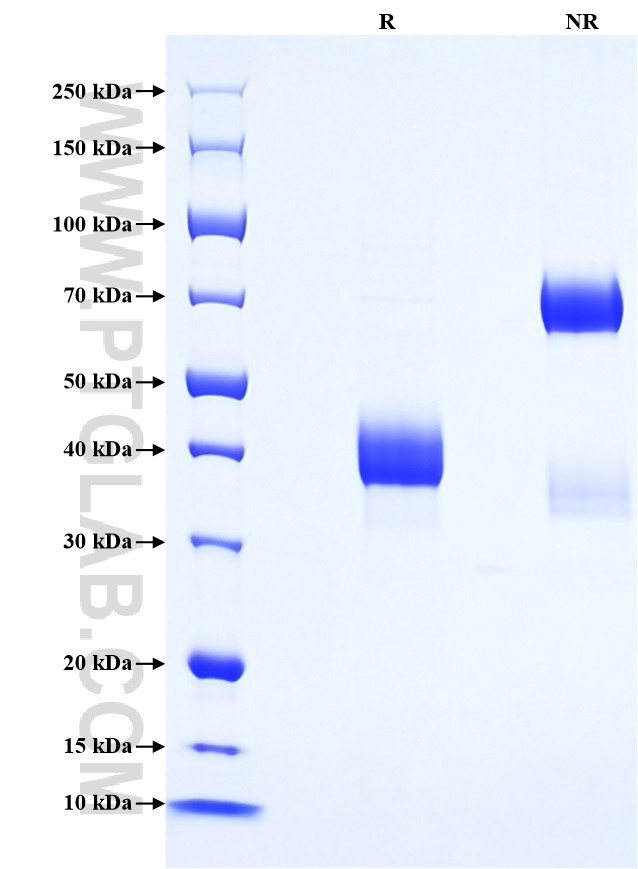 Purity of Recombinant Human CCL23 was determined by SDS-PAGE. The protein was resolved in an SDS-PAGE in reducing (R) and non-reducing (NR) conditions and stained using Coomassie blue.