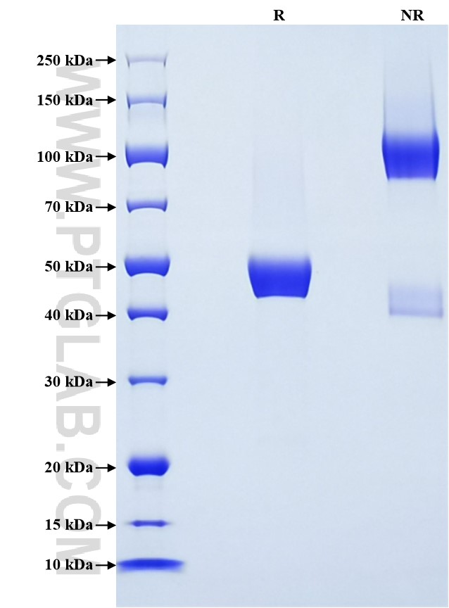 Purity of Recombinant Human LAIR2 was determined by SDS-PAGE. The protein was resolved in an SDS-PAGE in reducing (R) and non-reducing (NR) conditions and stained using Coomassie blue. Purity of Recombinant Human LAIR2 was determined by SDS-PAGE. The protein was resolved in an SDS-PAGE in reducing (R) and non-reducing (NR) conditions and stained using Coomassie blue.