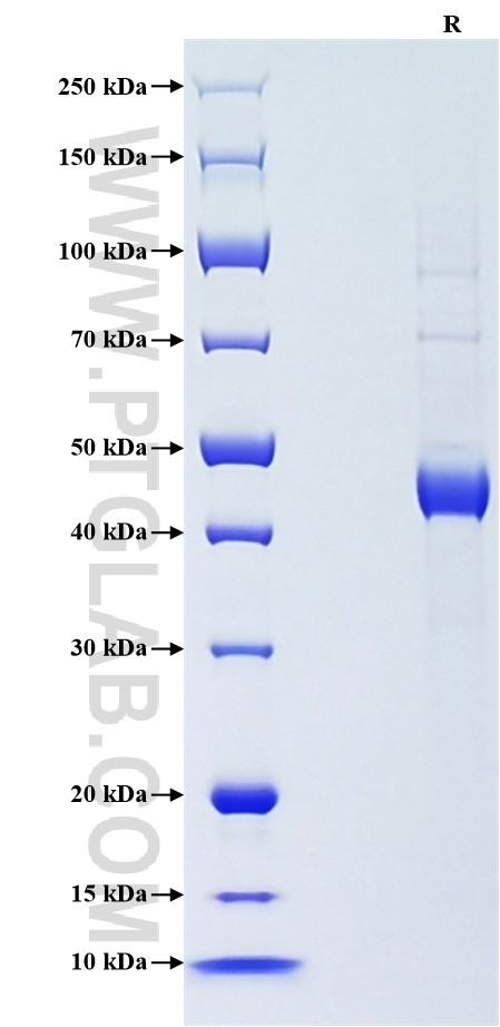 Purity of Recombinant Human LHB was determined by SDS-PAGE. The protein was resolved in an SDS-PAGE in reducing (R) conditions and stained using Coomassie blue. Purity of Recombinant Human LHB was determined by SDS-PAGE. The protein was resolved in an SDS-PAGE in reducing (R) conditions and stained using Coomassie blue.
