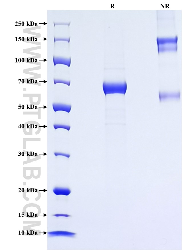 Purity of Recombinant Human KIR3DL3 was determined by SDS-PAGE. The protein was resolved in an SDS-PAGE in reducing (R) and non-reducing (NR) conditions and stained using Coomassie blue. Purity of Recombinant Human KIR3DL3 was determined by SDS-PAGE. The protein was resolved in an SDS-PAGE in reducing (R) and non-reducing (NR) conditions and stained using Coomassie blue.
