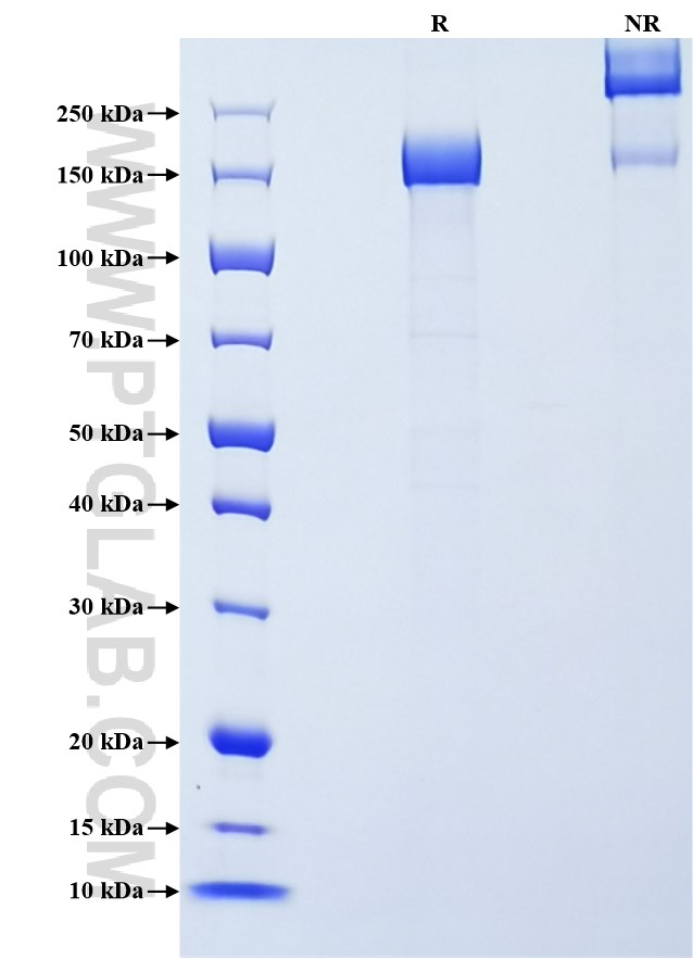 Purity of Recombinant Mouse G-CSFR was determined by SDS-PAGE. The protein was resolved in an SDS-PAGE in reducing (R) and non-reducing (NR) conditions and stained using Coomassie blue.