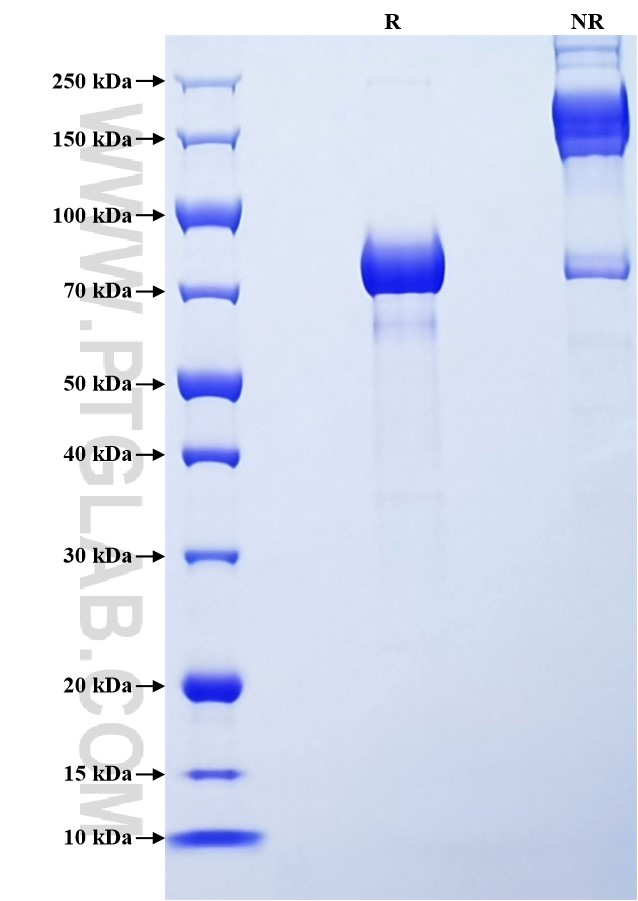 Purity of Recombinant Human COL23A1 was determined by SDS-PAGE. The protein was resolved in an SDS-PAGE in reducing (R) and non-reducing (NR) conditions and stained using Coomassie blue.