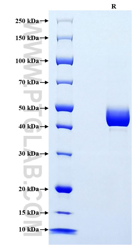 Purity of Recombinant Mouse Leptin was determined by SDS-PAGE. The protein was resolved in an SDS-PAGE in reducing (R) conditions and stained using Coomassie blue. Purity of Recombinant Mouse Leptin was determined by SDS-PAGE. The protein was resolved in an SDS-PAGE in reducing (R) conditions and stained using Coomassie blue.