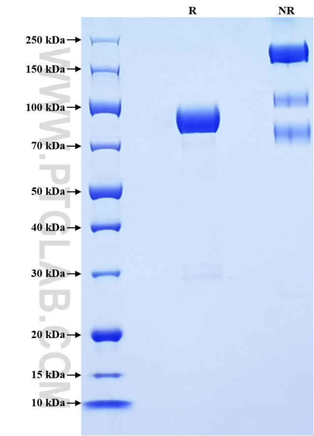 Purity of Recombinant Human BACE1 was determined by SDS-PAGE. The protein was resolved in an SDS-PAGE in reducing (R) and non-reducing (NR) conditions and stained using Coomassie blue. Purity of Recombinant Human BACE1 was determined by SDS-PAGE. The protein was resolved in an SDS-PAGE in reducing (R) and non-reducing (NR) conditions and stained using Coomassie blue.