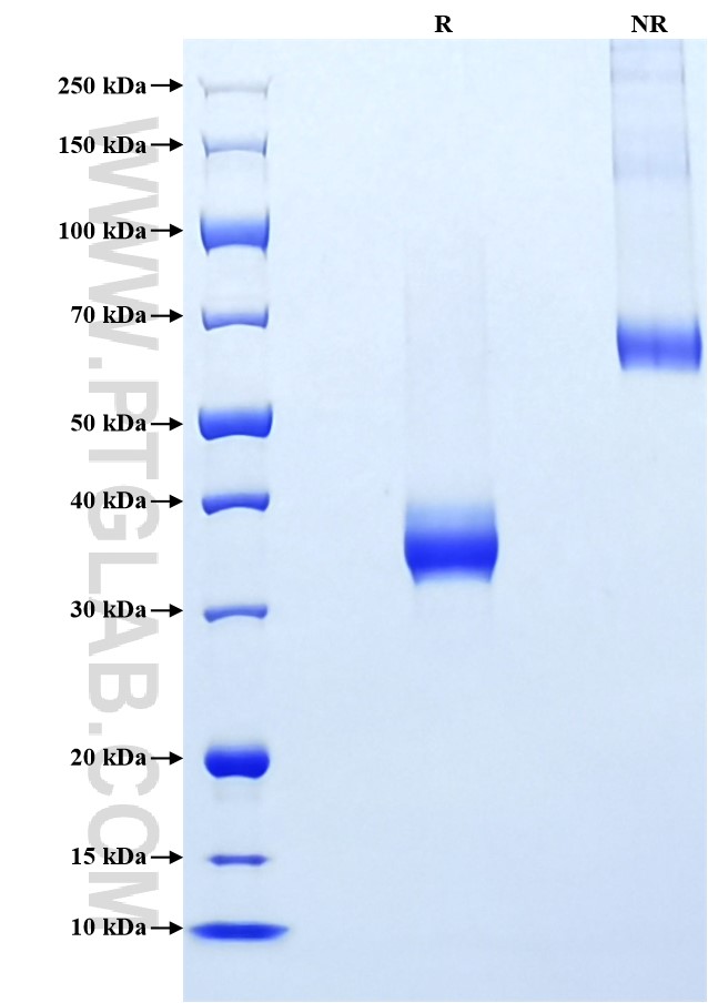 Purity of Recombinant Mouse IGF2 was determined by SDS-PAGE. The protein was resolved in an SDS-PAGE in reducing (R) and non-reducing (NR) conditions and stained using Coomassie blue. Purity of Recombinant Mouse IGF2 was determined by SDS-PAGE. The protein was resolved in an SDS-PAGE in reducing (R) and non-reducing (NR) conditions and stained using Coomassie blue.