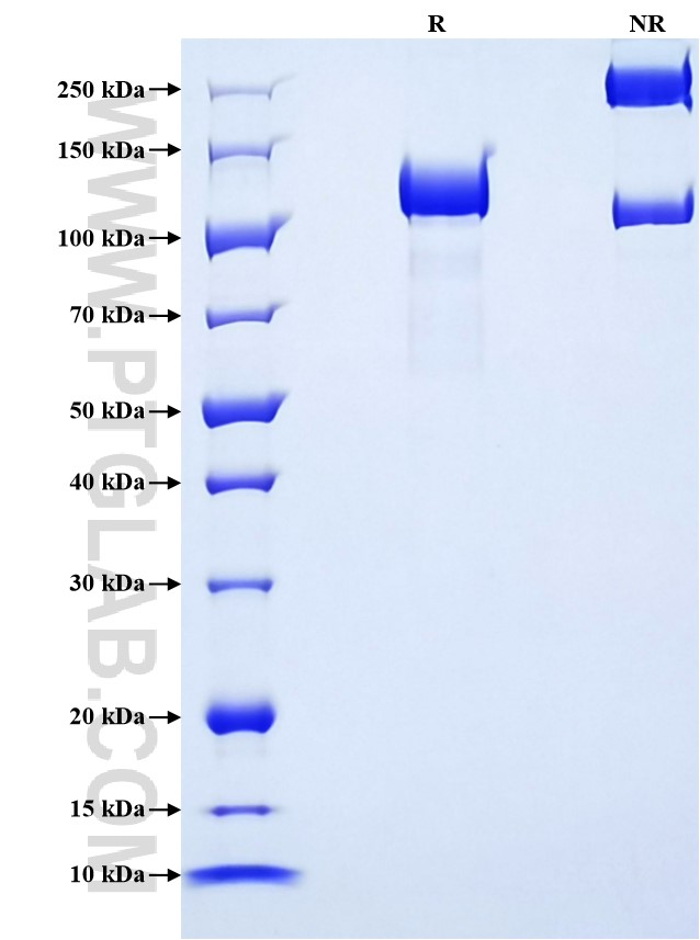 Purity of Recombinant Human Complement C6 was determined by SDS-PAGE. The protein was resolved in an SDS-PAGE in reducing (R) and non-reducing (NR) conditions and stained using Coomassie blue.