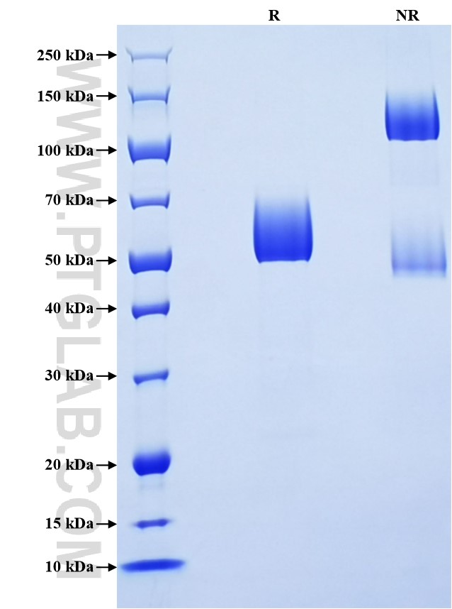 Purity of Recombinant Canine SCF was determined by SDS-PAGE. The protein was resolved in an SDS-PAGE in reducing (R) and non-reducing (NR) conditions and stained using Coomassie blue. Purity of Recombinant Canine SCF was determined by SDS-PAGE. The protein was resolved in an SDS-PAGE in reducing (R) and non-reducing (NR) conditions and stained using Coomassie blue.