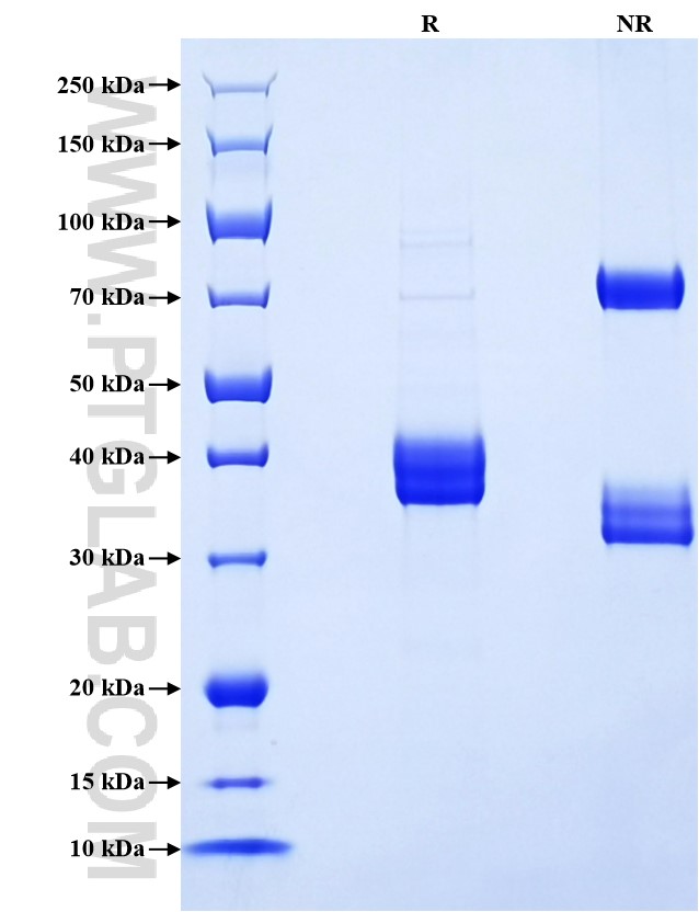 Purity of Recombinant Canine CXCL8 was determined by SDS-PAGE. The protein was resolved in an SDS-PAGE in reducing (R) and non-reducing (NR) conditions and stained using Coomassie blue. Purity of Recombinant Canine CXCL8 was determined by SDS-PAGE. The protein was resolved in an SDS-PAGE in reducing (R) and non-reducing (NR) conditions and stained using Coomassie blue.