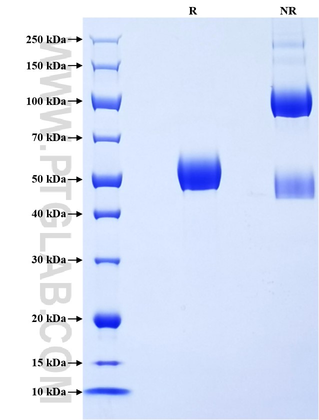 Purity of Recombinant Canine IL-6 was determined by SDS-PAGE. The protein was resolved in an SDS-PAGE in reducing (R) and non-reducing (NR) conditions and stained using Coomassie blue. Purity of Recombinant Canine IL-6 was determined by SDS-PAGE. The protein was resolved in an SDS-PAGE in reducing (R) and non-reducing (NR) conditions and stained using Coomassie blue.