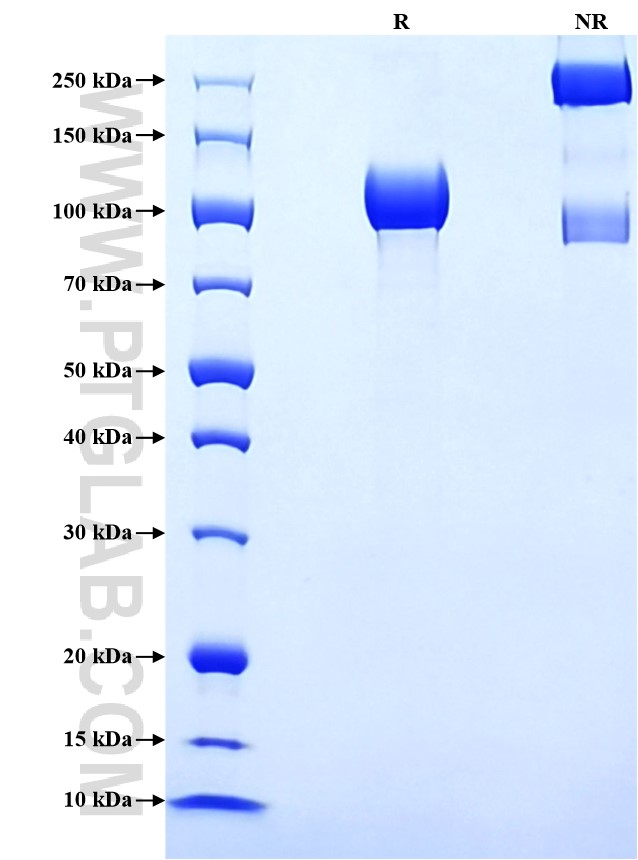 Purity of Recombinant Rhesus Monkey VCAM-1 was determined by SDS-PAGE. The protein was resolved in an SDS-PAGE in reducing (R) and non-reducing (NR) conditions and stained using Coomassie blue.