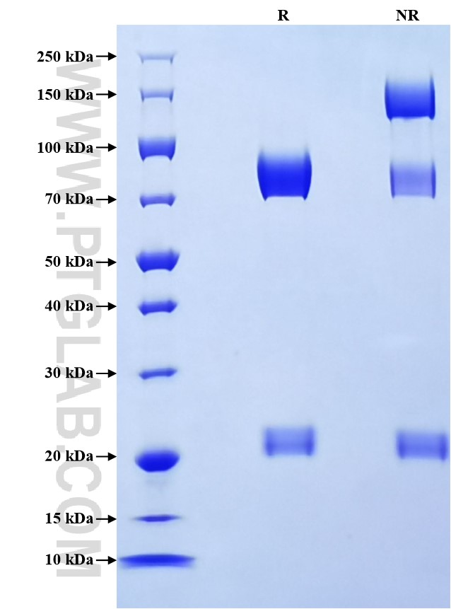 Purity of Recombinant Human GGT1 was determined by SDS-PAGE. The protein was resolved in an SDS-PAGE in reducing (R) and non-reducing (NR) conditions and stained using Coomassie blue. Purity of Recombinant Human GGT1 was determined by SDS-PAGE. The protein was resolved in an SDS-PAGE in reducing (R) and non-reducing (NR) conditions and stained using Coomassie blue.