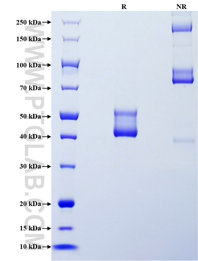 Purity of Recombinant Human HSP27 was determined by SDS-PAGE. The protein was resolved in an SDS-PAGE in reducing (R) and non-reducing (NR) conditions and stained using Coomassie blue. Purity of Recombinant Human HSP27 was determined by SDS-PAGE. The protein was resolved in an SDS-PAGE in reducing (R) and non-reducing (NR) conditions and stained using Coomassie blue.
