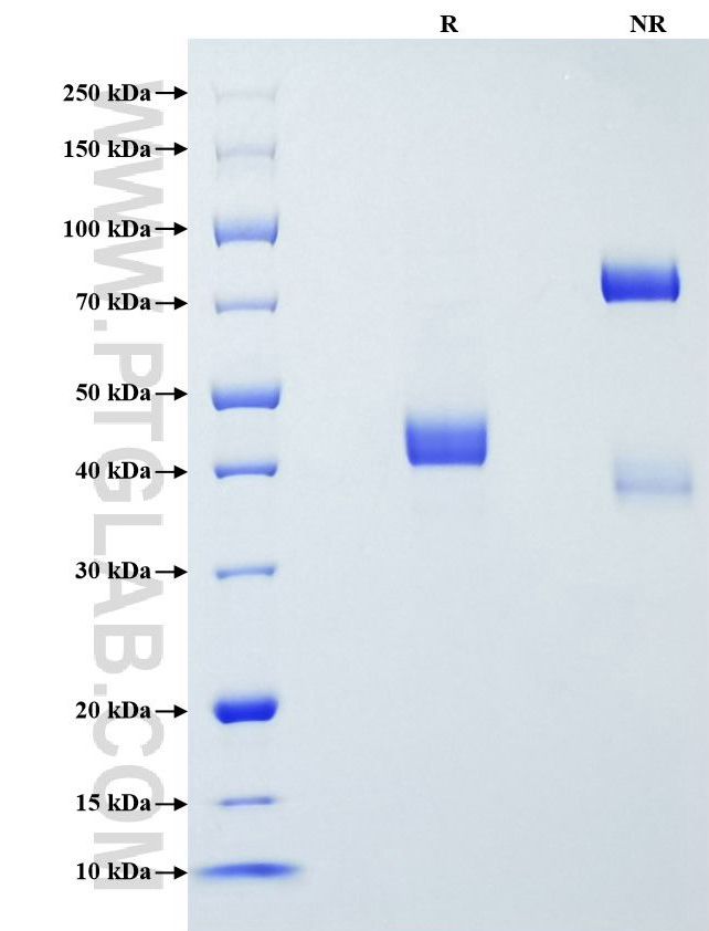 Purity of Recombinant Human Lysozyme was determined by SDS-PAGE. The protein was resolved in an SDS-PAGE in reducing (R) and non-reducing (NR) conditions and stained using Coomassie blue. Purity of Recombinant Human Lysozyme was determined by SDS-PAGE. The protein was resolved in an SDS-PAGE in reducing (R) and non-reducing (NR) conditions and stained using Coomassie blue.