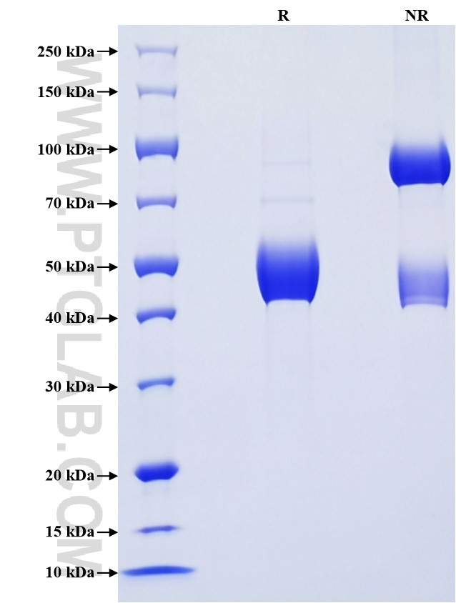 Purity of Recombinant Rat IL-1 alpha was determined by SDS-PAGE. The protein was resolved in an SDS-PAGE in reducing (R) and non-reducing (NR) conditions and stained using Coomassie blue. Purity of Recombinant Rat IL-1 alpha was determined by SDS-PAGE. The protein was resolved in an SDS-PAGE in reducing (R) and non-reducing (NR) conditions and stained using Coomassie blue.