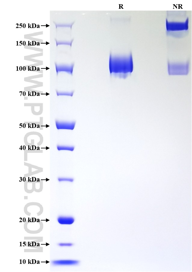 Purity of Recombinant Human CD31 was determined by SDS-PAGE. The protein was resolved in an SDS-PAGE in reducing (R) and non-reducing (NR) conditions and stained using Coomassie blue.