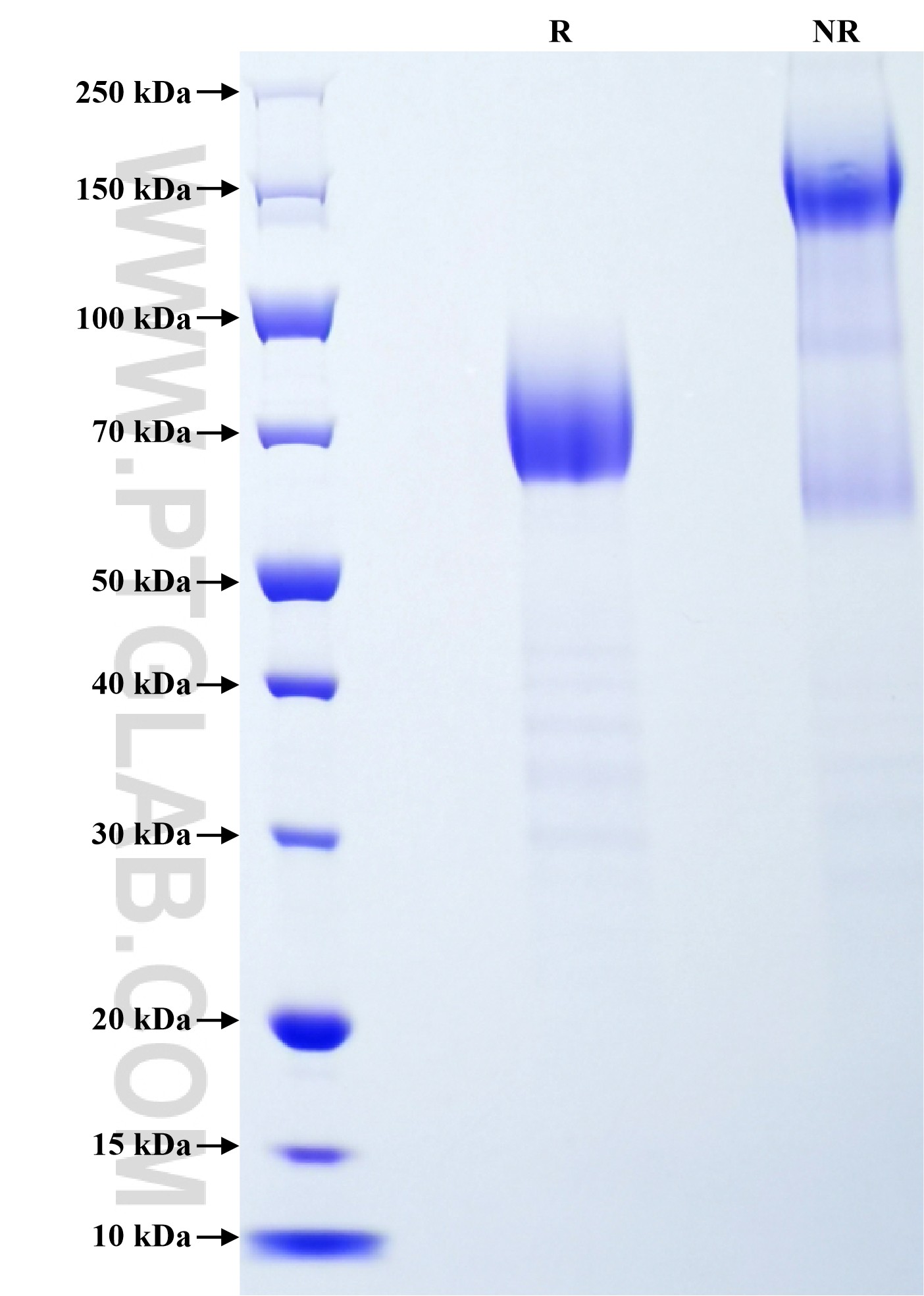 Purity of Recombinant Human DcR1 was determined by SDS-PAGE. The protein was resolved in an SDS-PAGE in reducing (R) and non-reducing (NR) conditions and stained using Coomassie blue. Purity of Recombinant Human DcR1 was determined by SDS-PAGE. The protein was resolved in an SDS-PAGE in reducing (R) and non-reducing (NR) conditions and stained using Coomassie blue.