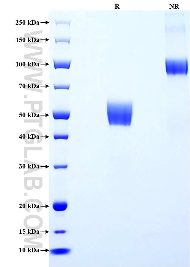 Purity of Recombinant Human GLP1R was determined by SDS-PAGE. The protein was resolved in an SDS-PAGE in reducing (R) and non-reducing (NR) conditions and stained using Coomassie blue. Purity of Recombinant Human GLP1R was determined by SDS-PAGE. The protein was resolved in an SDS-PAGE in reducing (R) and non-reducing (NR) conditions and stained using Coomassie blue.