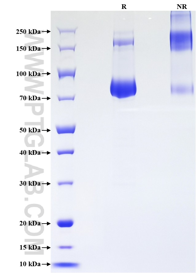Purity of Recombinant Human Serpin A4 was determined by SDS-PAGE. The protein was resolved in an SDS-PAGE in reducing (R) and non-reducing (NR) conditions and stained using Coomassie blue.