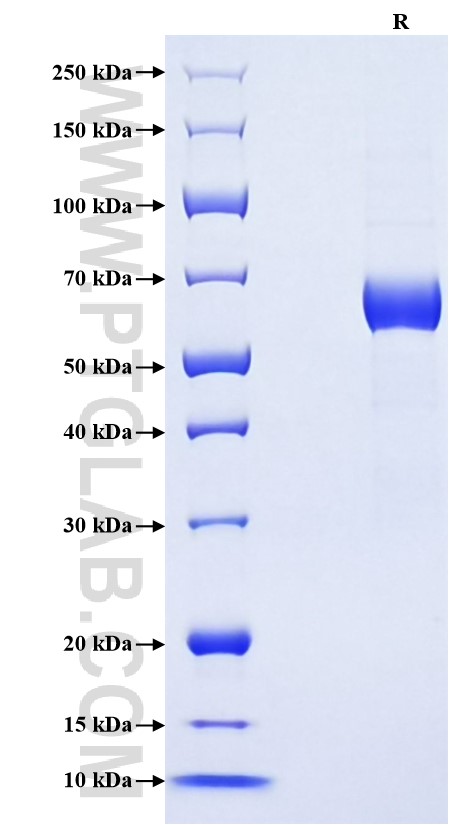 Purity of Recombinant Human Angiopoietin 4 was determined by SDS-PAGE. The protein was resolved in an SDS-PAGE in reducing (R) conditions and stained using Coomassie blue. Purity of Recombinant Human Angiopoietin 4 was determined by SDS-PAGE. The protein was resolved in an SDS-PAGE in reducing (R) conditions and stained using Coomassie blue.