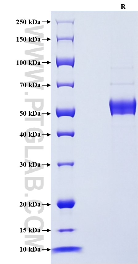Purity of Recombinant Mouse Ferritin heavy chain was determined by SDS-PAGE. The protein was resolved in an SDS-PAGE in reducing (R) conditions and stained using Coomassie blue. Purity of Recombinant Mouse Ferritin heavy chain was determined by SDS-PAGE. The protein was resolved in an SDS-PAGE in reducing (R) conditions and stained using Coomassie blue.