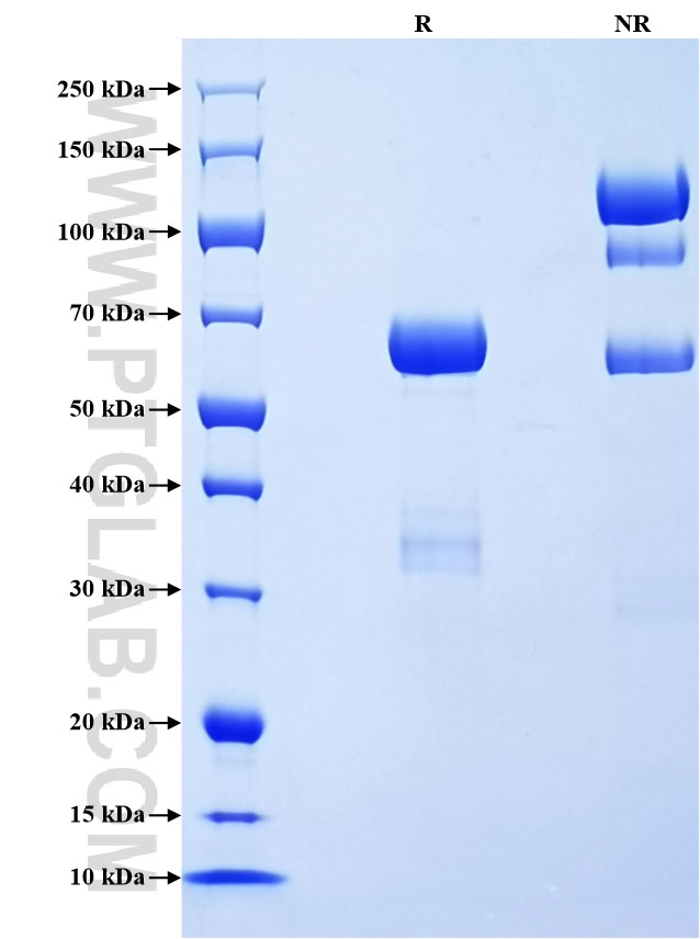 Purity of Recombinant Human PGC was determined by SDS-PAGE. The protein was resolved in an SDS-PAGE in reducing (R) and non-reducing (NR) conditions and stained using Coomassie blue. Purity of Recombinant Human PGC was determined by SDS-PAGE. The protein was resolved in an SDS-PAGE in reducing (R) and non-reducing (NR) conditions and stained using Coomassie blue.