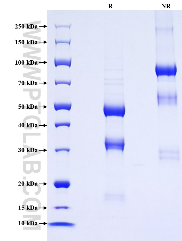 Purity of Recombinant Human P21 was determined by SDS-PAGE. The protein was resolved in an SDS-PAGE in reducing (R) and non-reducing (NR) conditions and stained using Coomassie blue.