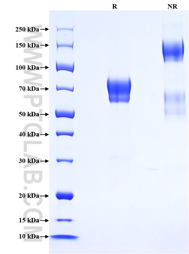 Purity of Recombinant Human NGFR was determined by SDS-PAGE. The protein was resolved in an SDS-PAGE in reducing (R) and non-reducing (NR) conditions and stained using Coomassie blue. Purity of Recombinant Human NGFR was determined by SDS-PAGE. The protein was resolved in an SDS-PAGE in reducing (R) and non-reducing (NR) conditions and stained using Coomassie blue.
