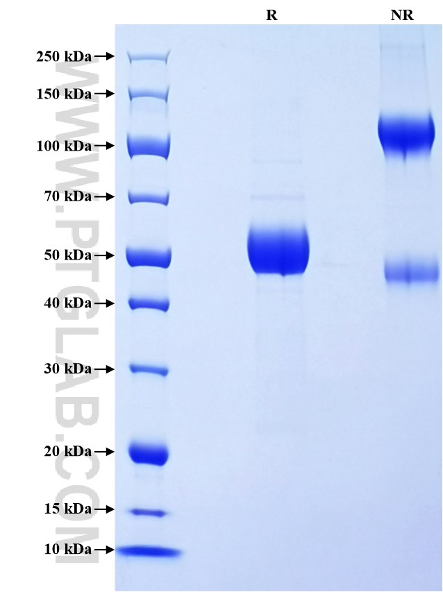 Purity of Recombinant Human CD8B was determined by SDS-PAGE. The protein was resolved in an SDS-PAGE in reducing (R) and non-reducing (NR) conditions and stained using Coomassie blue. Purity of Recombinant Human CD8B was determined by SDS-PAGE. The protein was resolved in an SDS-PAGE in reducing (R) and non-reducing (NR) conditions and stained using Coomassie blue.