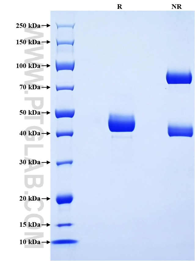 Purity of Recombinant Pig TNF-alpha was determined by SDS-PAGE. The protein was resolved in an SDS-PAGE in reducing (R) and non-reducing (NR) conditions and stained using Coomassie blue. Purity of Recombinant Pig TNF-alpha was determined by SDS-PAGE. The protein was resolved in an SDS-PAGE in reducing (R) and non-reducing (NR) conditions and stained using Coomassie blue.