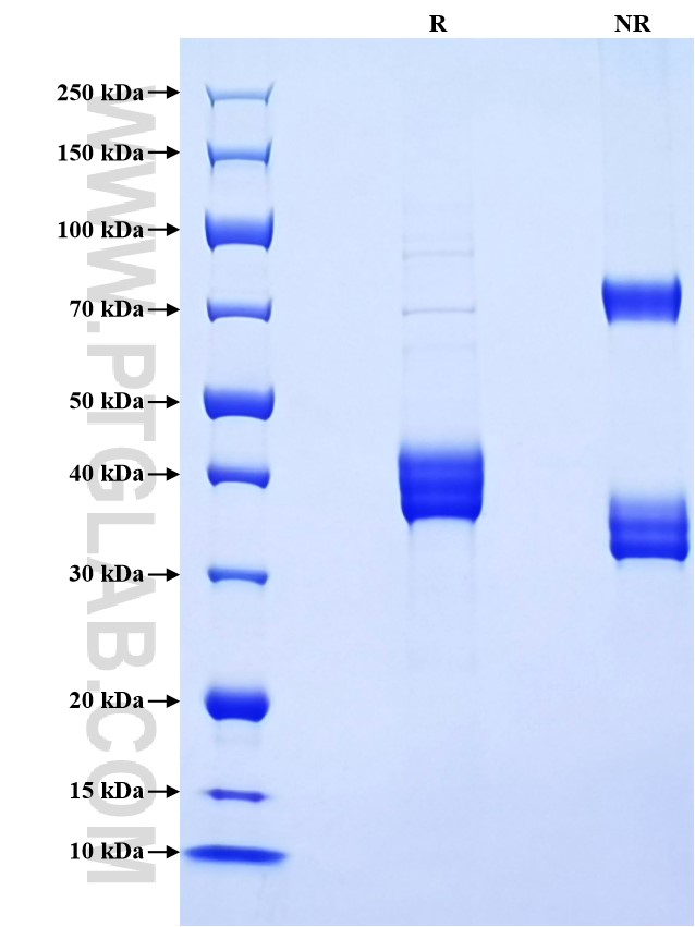 Purity of Recombinant Pig CXCL8 was determined by SDS-PAGE. The protein was resolved in an SDS-PAGE in reducing (R) and non-reducing (NR) conditions and stained using Coomassie blue. Purity of Recombinant Pig CXCL8 was determined by SDS-PAGE. The protein was resolved in an SDS-PAGE in reducing (R) and non-reducing (NR) conditions and stained using Coomassie blue.