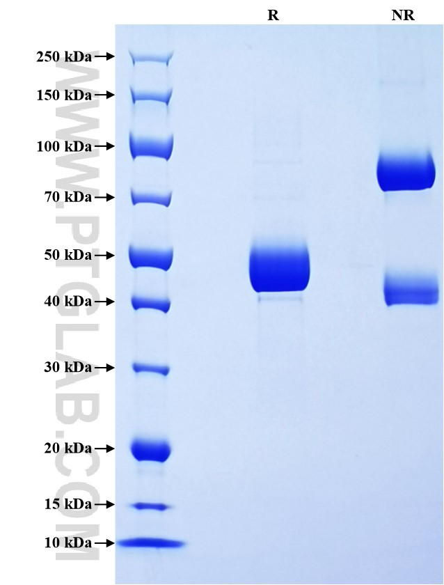 Purity of Recombinant Pig IL-10 was determined by SDS-PAGE. The protein was resolved in an SDS-PAGE in reducing (R) and non-reducing (NR) conditions and stained using Coomassie blue. Purity of Recombinant Pig IL-10 was determined by SDS-PAGE. The protein was resolved in an SDS-PAGE in reducing (R) and non-reducing (NR) conditions and stained using Coomassie blue.