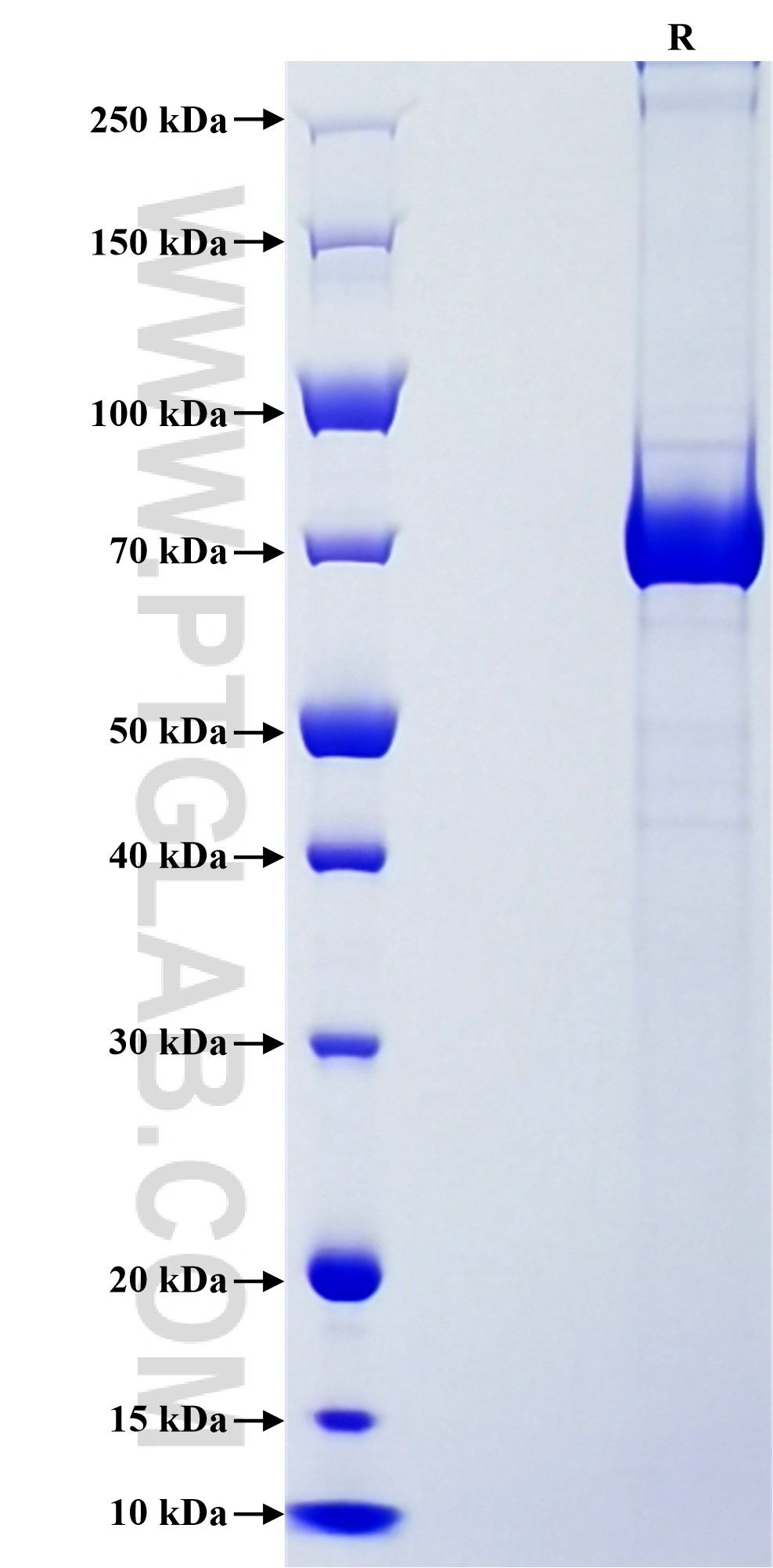 Purity of Recombinant Human GAS6 was determined by SDS-PAGE. The protein was resolved in an SDS-PAGE in reducing (R) conditions and stained using Coomassie blue. Purity of Recombinant Human GAS6 was determined by SDS-PAGE. The protein was resolved in an SDS-PAGE in reducing (R) conditions and stained using Coomassie blue.
