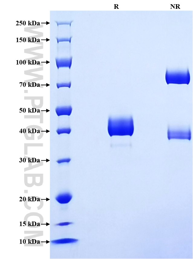 Purity of Recombinant Human Cystatin SN was determined by SDS-PAGE. The protein was resolved in an SDS-PAGE in reducing (R) and non-reducing (NR) conditions and stained using Coomassie blue. Purity of Recombinant Human Cystatin SN was determined by SDS-PAGE. The protein was resolved in an SDS-PAGE in reducing (R) and non-reducing (NR) conditions and stained using Coomassie blue.