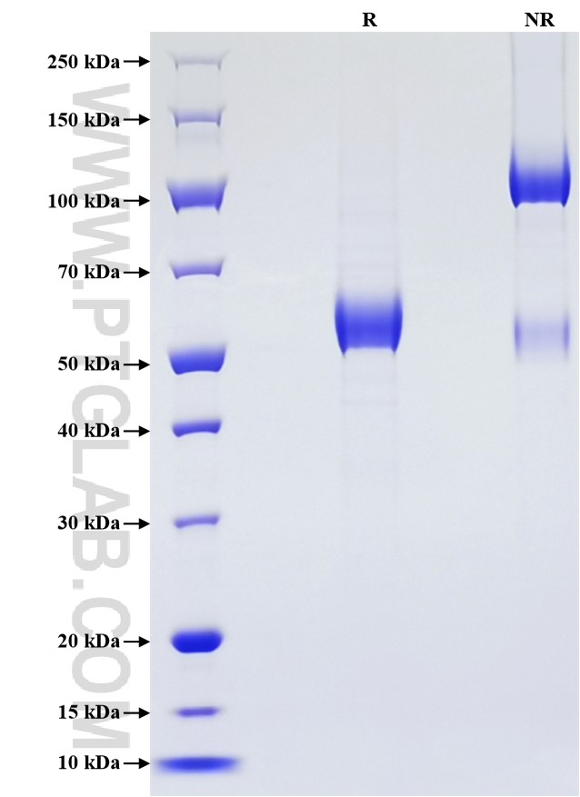 Purity of Recombinant Human ATP1B3 was determined by SDS-PAGE. The protein was resolved in an SDS-PAGE in reducing (R) and non-reducing (NR) conditions and stained using Coomassie blue. Purity of Recombinant Human ATP1B3 was determined by SDS-PAGE. The protein was resolved in an SDS-PAGE in reducing (R) and non-reducing (NR) conditions and stained using Coomassie blue.