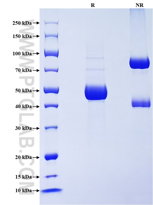 Purity of Recombinant Human IFNA10 was determined by SDS-PAGE. The protein was resolved in an SDS-PAGE in reducing (R) and non-reducing (NR) conditions and stained using Coomassie blue. Purity of Recombinant Human IFNA10 was determined by SDS-PAGE. The protein was resolved in an SDS-PAGE in reducing (R) and non-reducing (NR) conditions and stained using Coomassie blue.