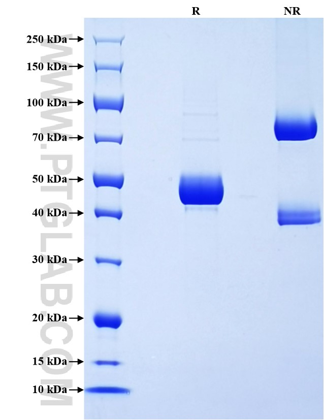 Purity of Recombinant Human IFNA8 was determined by SDS-PAGE. The protein was resolved in an SDS-PAGE in reducing (R) and non-reducing (NR) conditions and stained using Coomassie blue.