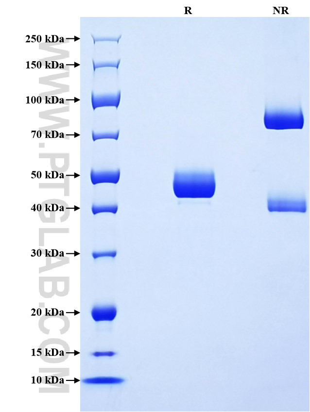Purity of Recombinant Human IFNA5 was determined by SDS-PAGE. The protein was resolved in an SDS-PAGE in reducing (R) and non-reducing (NR) conditions and stained using Coomassie blue. Purity of Recombinant Human IFNA5 was determined by SDS-PAGE. The protein was resolved in an SDS-PAGE in reducing (R) and non-reducing (NR) conditions and stained using Coomassie blue.