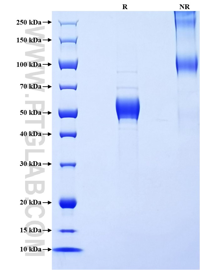 Purity of Recombinant Human IL-1F6 was determined by SDS-PAGE. The protein was resolved in an SDS-PAGE in reducing (R) and non-reducing (NR) conditions and stained using Coomassie blue. Purity of Recombinant Human IL-1F6 was determined by SDS-PAGE. The protein was resolved in an SDS-PAGE in reducing (R) and non-reducing (NR) conditions and stained using Coomassie blue.