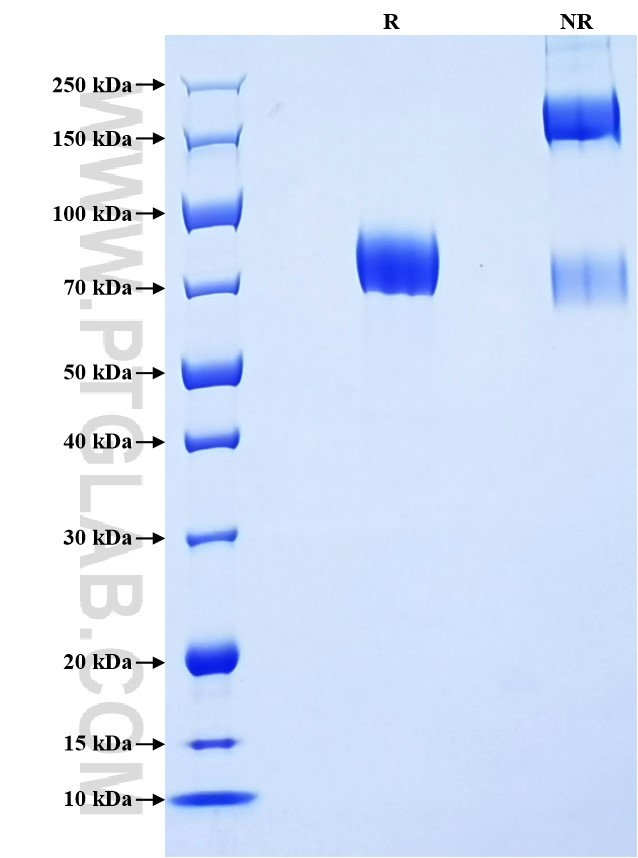 Purity of Recombinant Human IL-17RD was determined by SDS-PAGE. The protein was resolved in an SDS-PAGE in reducing (R) and non-reducing (NR) conditions and stained using Coomassie blue.